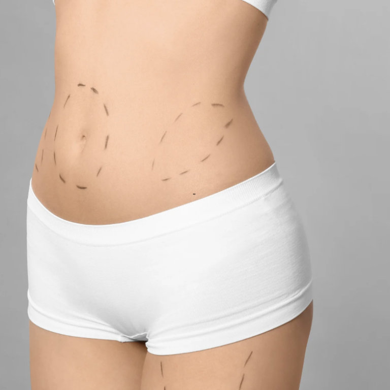 Tummy Tuck Surgery Prices in Fairfax VA